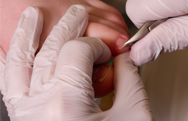 Podologia-Grodzisk-Mazowiecki